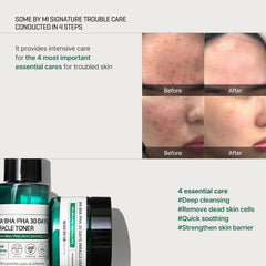 SOME BY MI AHA BHA PHA 30 Days Miracle Starter Kit - JINAE