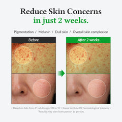 Dr. Althea Gentle Vitamin C Serum