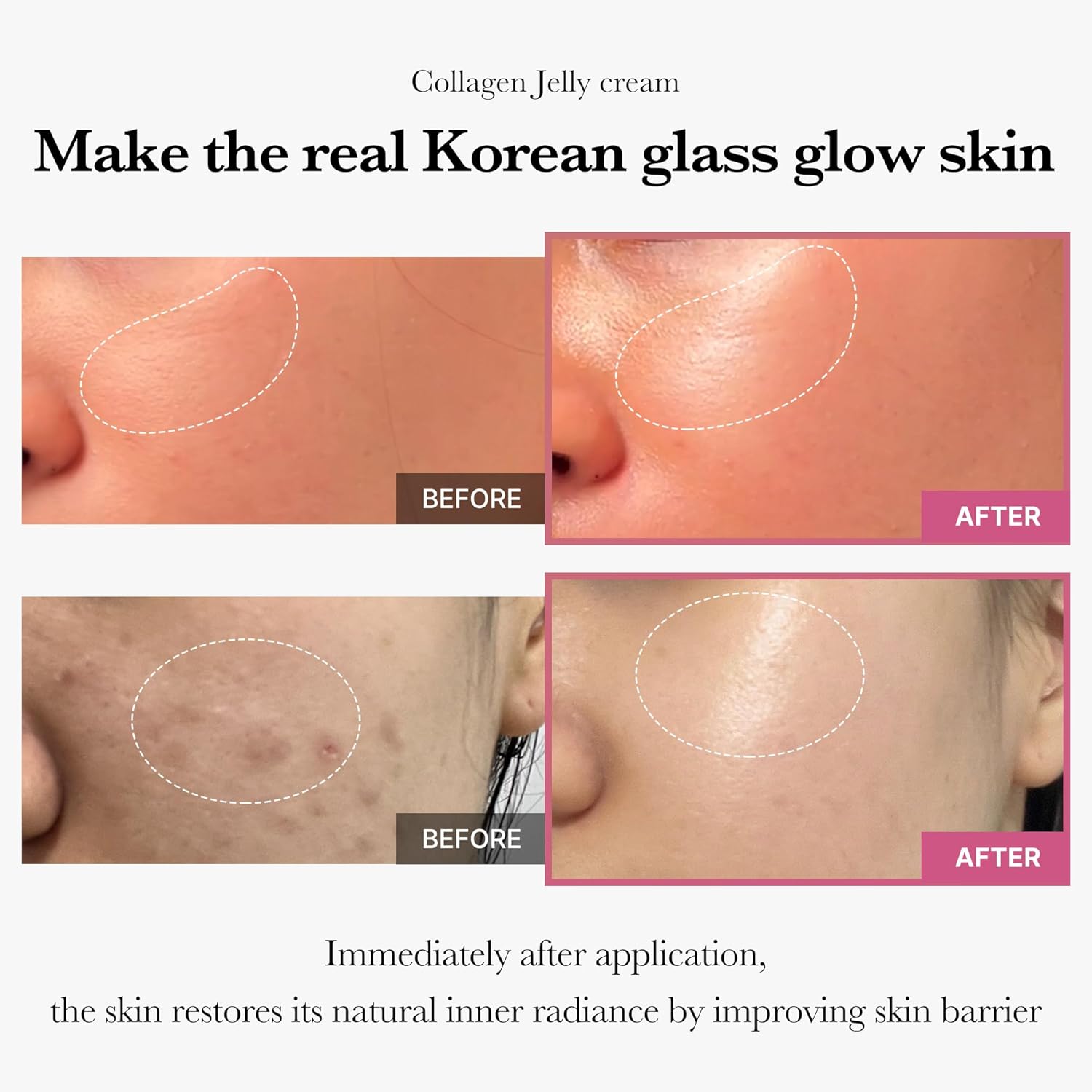 Medicube Collagen Jelly Cream - JINAE