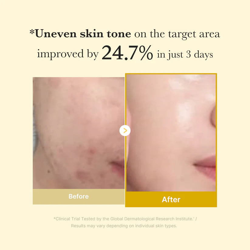 Medicube Kojic Acid Turmeric Overnight Wrapping Mask 75ml - JINAE