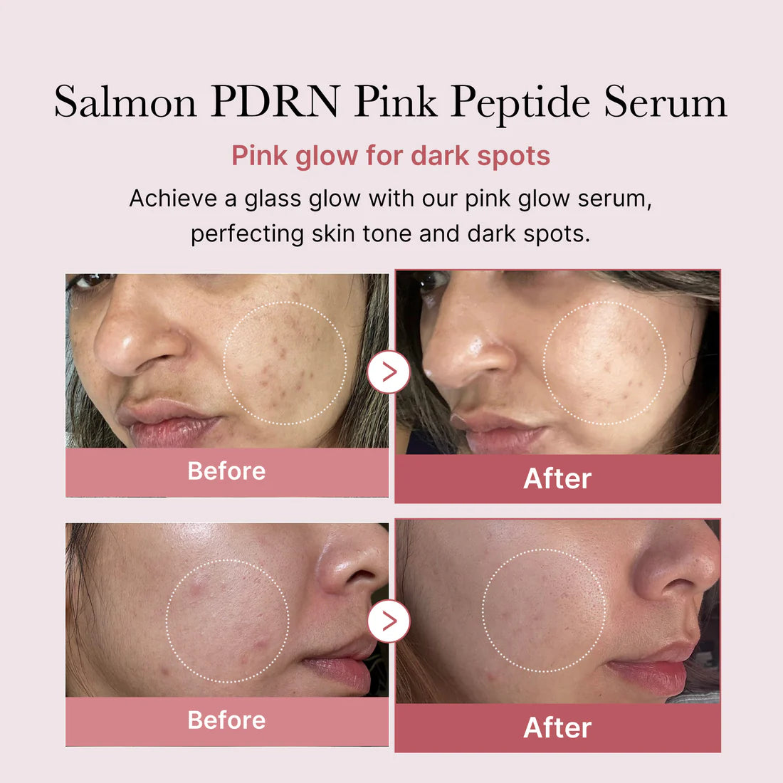 Medicube PDRN Pink Peptide Serum 30ml - JINAE