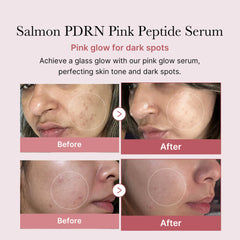 Medicube PDRN Pink Peptide Serum 30ml - JINAE