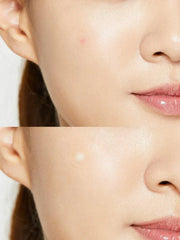 COSRX Acne Pimple Master Patch - JINAE