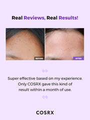 COSRX AHA/BHA Clarifying Treatment Toner 150ml - JINAE