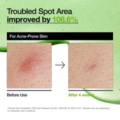 ANUA Azelaic Acid 10 Hyaluron Redness Soothing Serum - JINAE