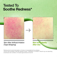 ANUA Azelaic Acid 10 Hyaluron Redness Soothing Serum - JINAE